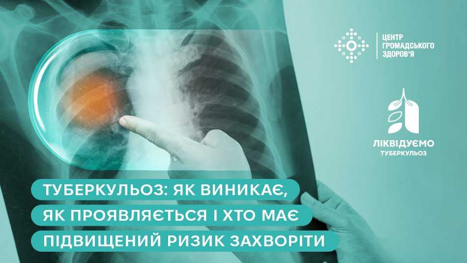 Туберкульоз: як виникає, як проявляється і хто має підвищений ризик захворіти